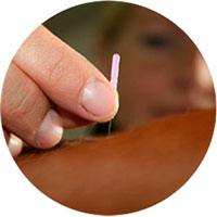 Kranio-sakralterapi og akupunktur